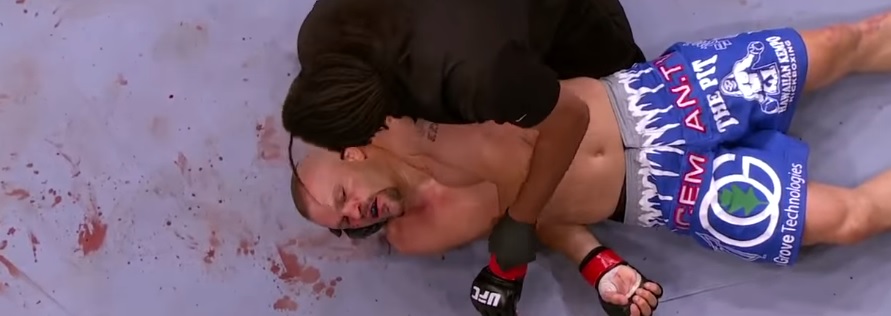 20 najlepszych nokautów w UFC